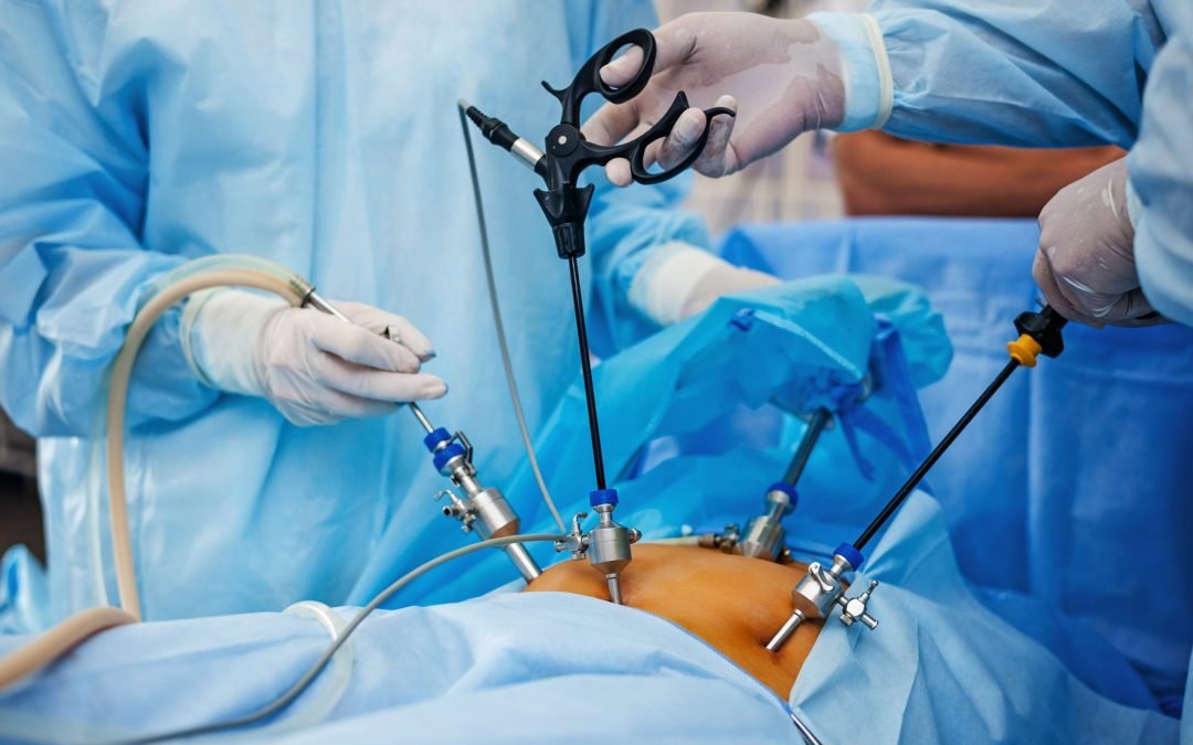 Best Laparoscopic Surgery in Indirapuram