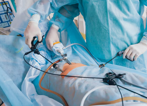 You are currently viewing How Safe and Effective is Gallbladder Removal Surgery (Cholecystectomy) at Madhup Hospital in Ghaziabad?
