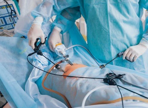 You are currently viewing What are the main benefits of choosing Durbin Vidhi gallbladder surgery at Madhup Hospital?