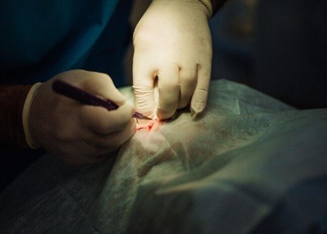 Best Fissure Surgeon Hospital in Indirapuram