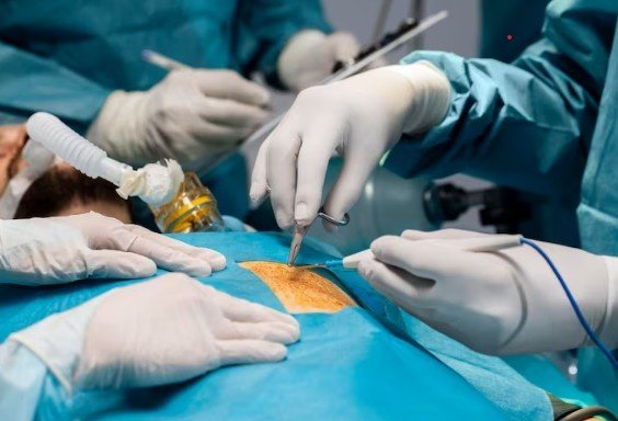 Best Fistula Surgeon in Indirapuram