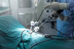 Read more about the article What should patients expect before, during, and after Laparoscopic Surgery in Ghaziabad at Madhup Hospital?
