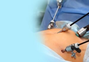 Read more about the article Why Should I Choose a Laparoscopic Surgeon in Indirapuram for Minimally Invasive Surgery?