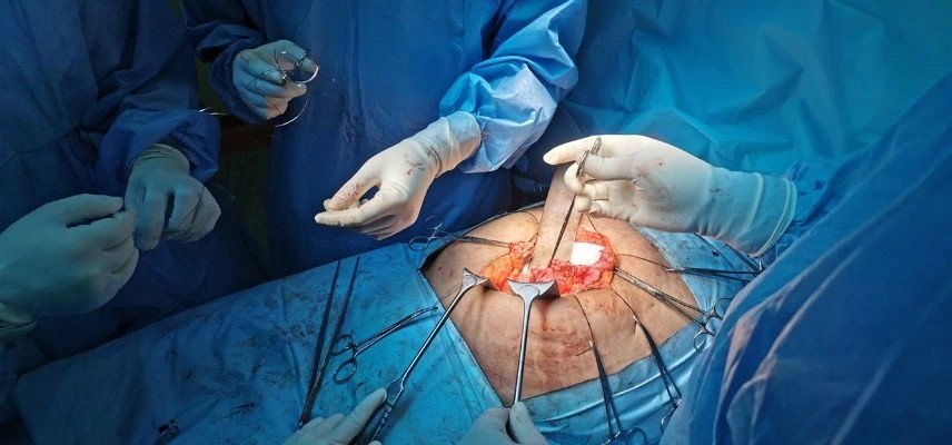 General Surgery in Ghaziabad